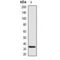 LifeSab™ SCO1 Rabbit pAb (50 µl)