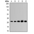 LifeSab™ RISP Rabbit pAb (50 µl)