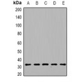 LifeSab™ DGUOK Rabbit pAb (50 µl)