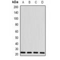 LifeSab™ BLVRB Rabbit pAb (50 µl)