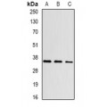 LifeSab™ Aspartoacylase Rabbit pAb (50 µl)