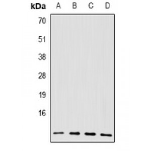 LifeSab™ BRCC2 Rabbit pAb (50 µl)