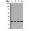 LifeSab™ FAM173B Rabbit pAb (50 µl)