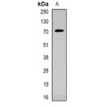 LifeSab™ CACNB1 Rabbit pAb (50 µl)