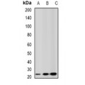 LifeSab™ GSTA2 Rabbit pAb (50 µl)