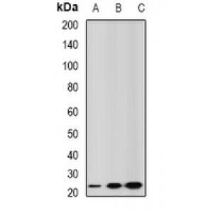 LifeSab™ GSTA2 Rabbit pAb (50 µl)