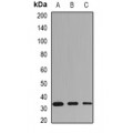 LifeSab™ HLA-DRB1 Rabbit pAb (50 µl)