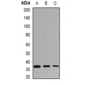 LifeSab™ HLA-DRB1 Rabbit pAb (50 µl)