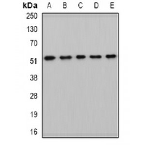 LifeSab™ HARS2 Rabbit pAb (50 µl)