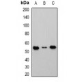 LifeSab™ Cbl-3 Rabbit pAb (50 µl)