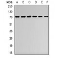 LifeSab™ AspRS Rabbit pAb (50 µl)