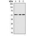 LifeSab™ PHF21B Rabbit pAb (50 µl)