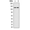 LifeSab™ CCDC52 Rabbit pAb (50 µl)