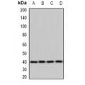 LifeSab™ ACAT2 Rabbit pAb (50 µl)