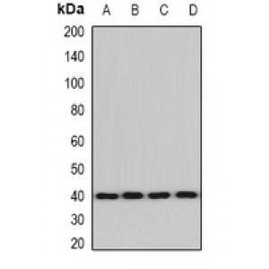 LifeSab™ ACAT2 Rabbit pAb (50 µl)