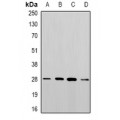 LifeSab™ PGAM2 Rabbit pAb (50 µl)