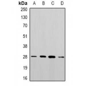 LifeSab™ PGAM2 Rabbit pAb (50 µl)