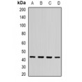 LifeSab™ ST3GAL5 Rabbit pAb (50 µl)