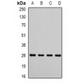 LifeSab™ Metaxin-2 Rabbit pAb (50 µl)