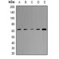 LifeSab™ MCCB Rabbit pAb (50 µl)