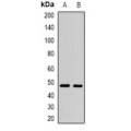 LifeSab™ AMY2A Rabbit pAb (50 µl)