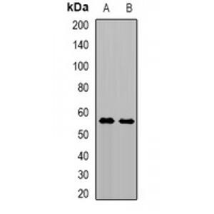 LifeSab™ TRMT61B Rabbit pAb (50 µl)