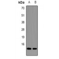 LifeSab™ CGRP2 Rabbit pAb (50 µl)