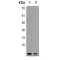 LifeSab™ NDUFA2 Rabbit pAb (50 µl)