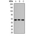 LifeSab™ Sulphamidase Rabbit pAb (50 µl)