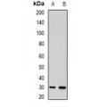 LifeSab™ UPIb Rabbit pAb (50 µl)