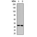 LifeSab™ FBXO22 Rabbit pAb (50 µl)