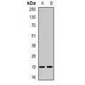 LifeSab™ NUDT15 Rabbit pAb (50 µl)