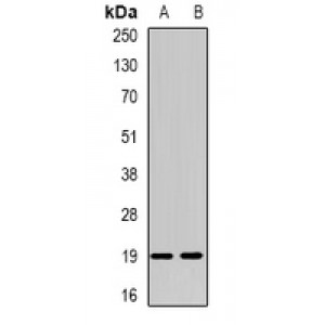 LifeSab™ NUDT15 Rabbit pAb (50 µl)