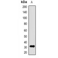 LifeSab™ Kua Rabbit pAb (50 µl)