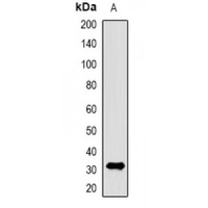 LifeSab™ Kua Rabbit pAb (50 µl)