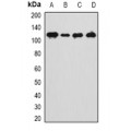 LifeSab™ ANKRD28 Rabbit pAb (50 µl)