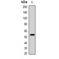 LifeSab™ CMG2 Rabbit pAb (50 µl)