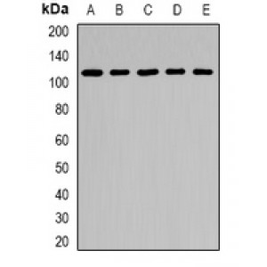 LifeSab™ ARHGAP44 Rabbit pAb (50 µl)