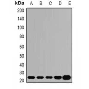 LifeSab™ ATP5O Rabbit pAb (50 µl)