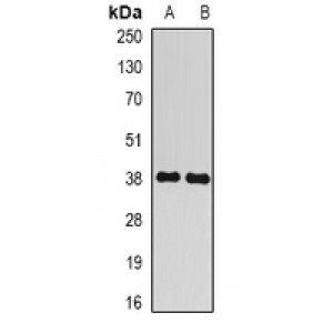 LifeSab™ BCLG Rabbit pAb (50 µl)