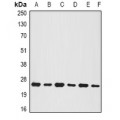 LifeSab™ BNIP1 Rabbit pAb (50 µl)