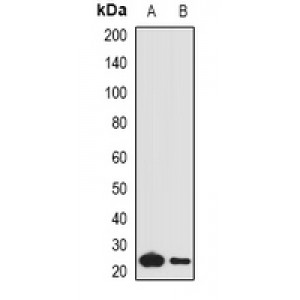 LifeSab™ Complement C1QA Rabbit pAb (50 µl)