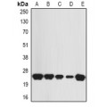 LifeSab™ KNP-I Rabbit pAb (50 µl)