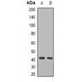 LifeSab™ CCR8 Rabbit pAb (50 µl)