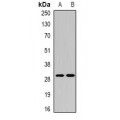 LifeSab™ CEACAM7 Rabbit pAb (50 µl)