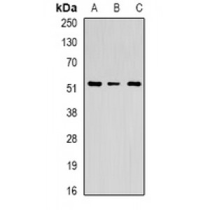 LifeSab™ Chitotriosidase Rabbit pAb (50 µl)