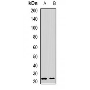 LifeSab™ Tetranectin Rabbit pAb (50 µl)