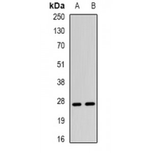 LifeSab™ TSP1 Rabbit pAb (50 µl)