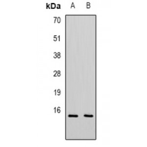 LifeSab™ CXCL11 Rabbit pAb (50 µl)