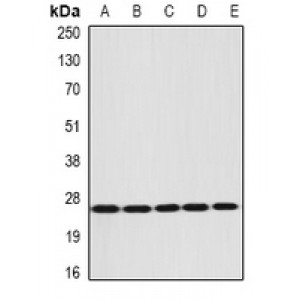 LifeSab™ DIRAS3 Rabbit pAb (50 µl)